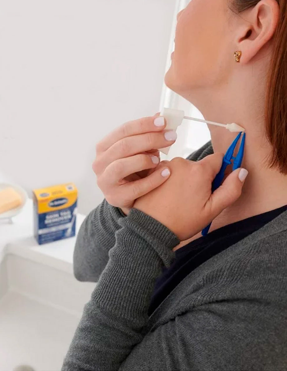Removing Skin Tags Made Easy with Dr. Scholl's 2